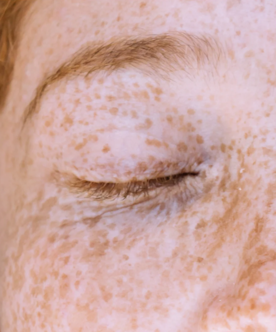 Dark Spot Routine Duo