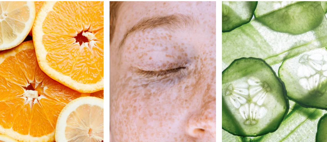 Targeted Dark Spot Care, 1% Kojic Acid